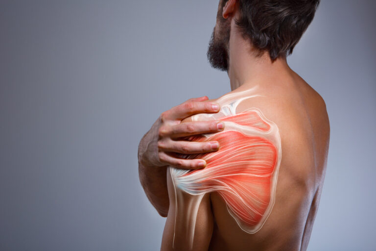 A Comprehensive Guide to Understanding and Alleviating Shoulder Pain.