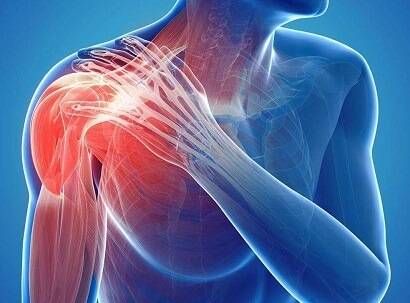 Shoulder Pain Treatment