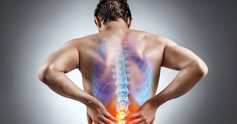 Understanding and Managing Back Pain: A Comprehensive Guide.