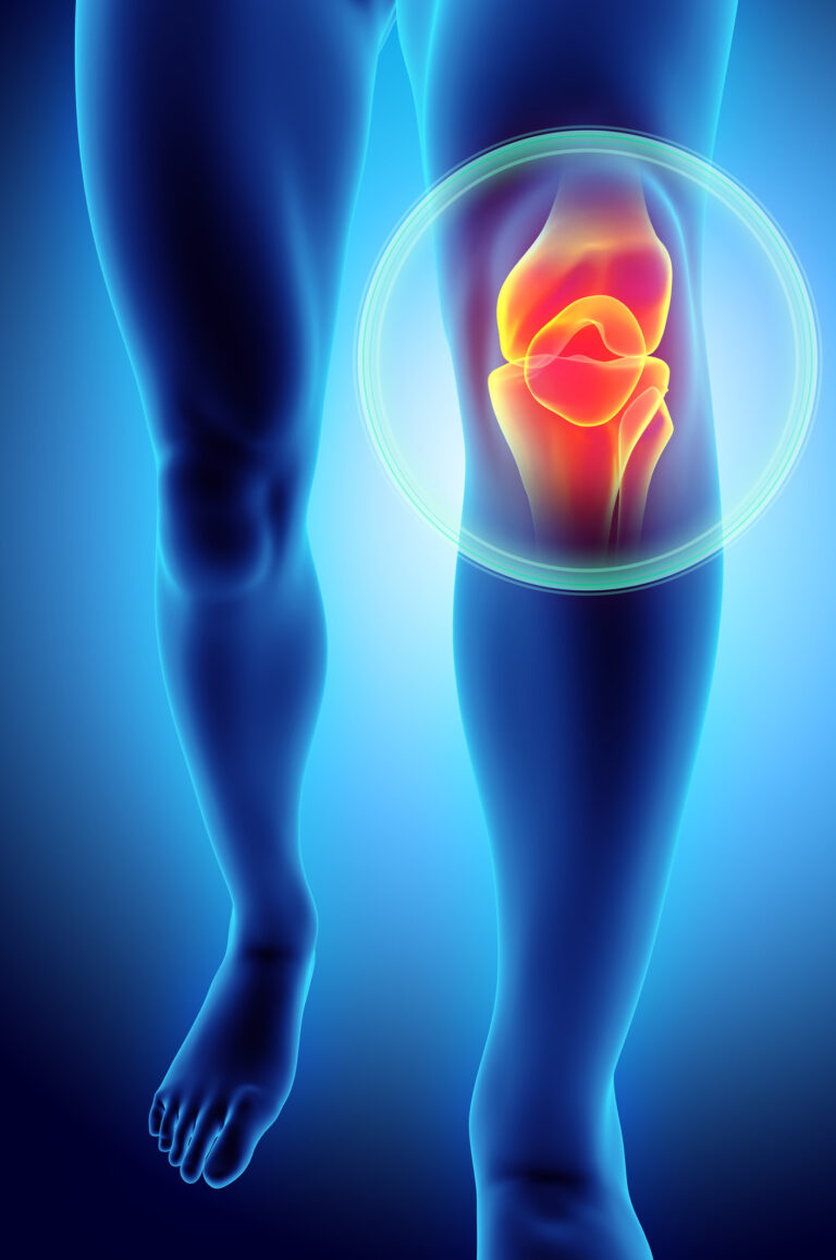 Understanding and Managing Knee Pain Causes, Symptoms, and Treatment Options.