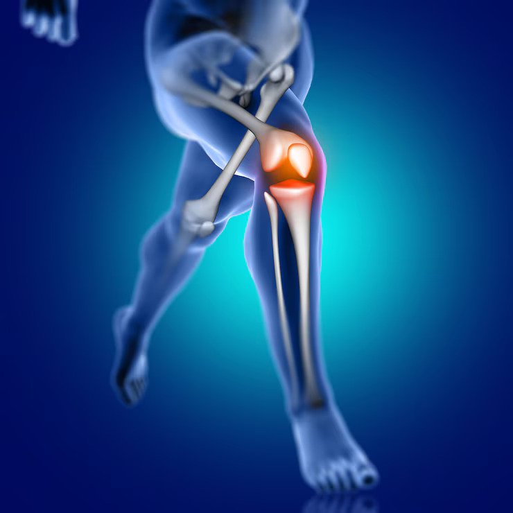 Managing Knee Pain In Athletes And Active Individuals