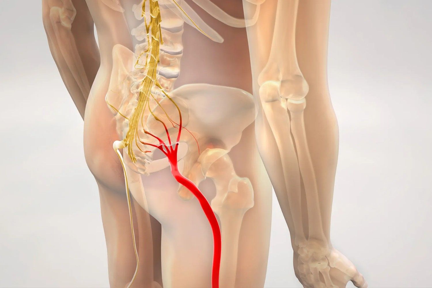 Sciatica Treatment in Dilshad Garden