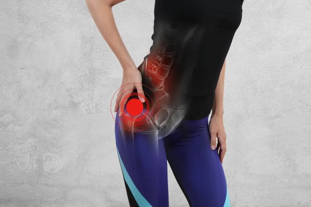 Hip Pain Specialist in Delhi